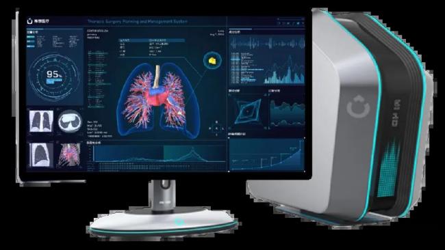 全球首个且唯一ai-4d智能手术规划系统