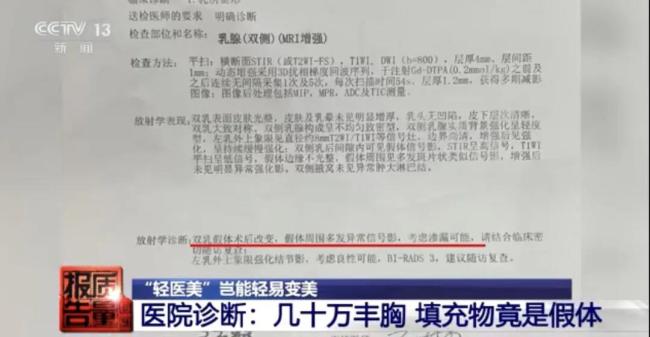 日本功能性标示食品又现117起健康受损报告